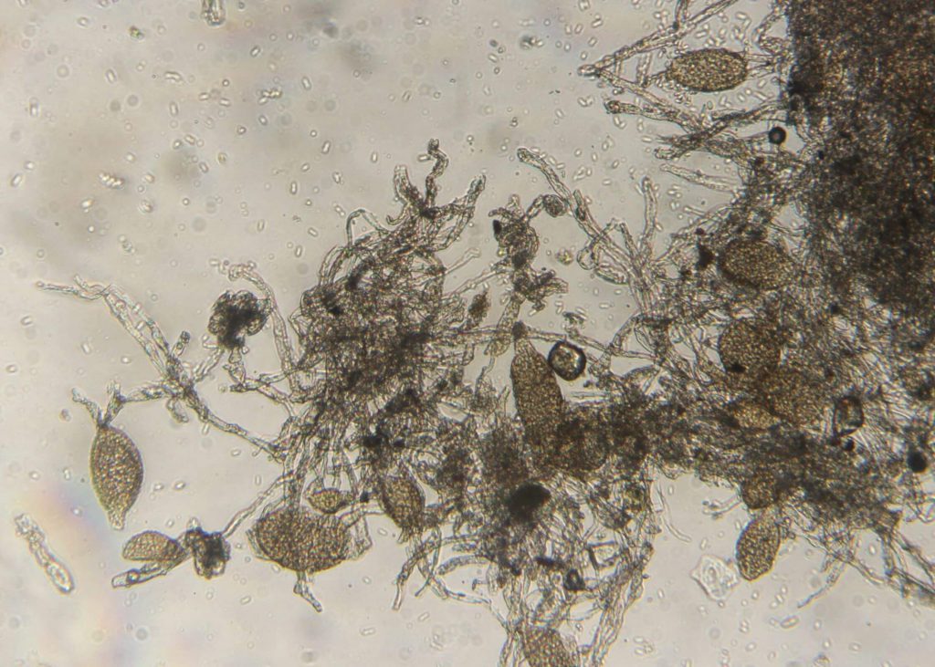 A microscopic view of a fungus parasitizing another fungus causing downy mildew