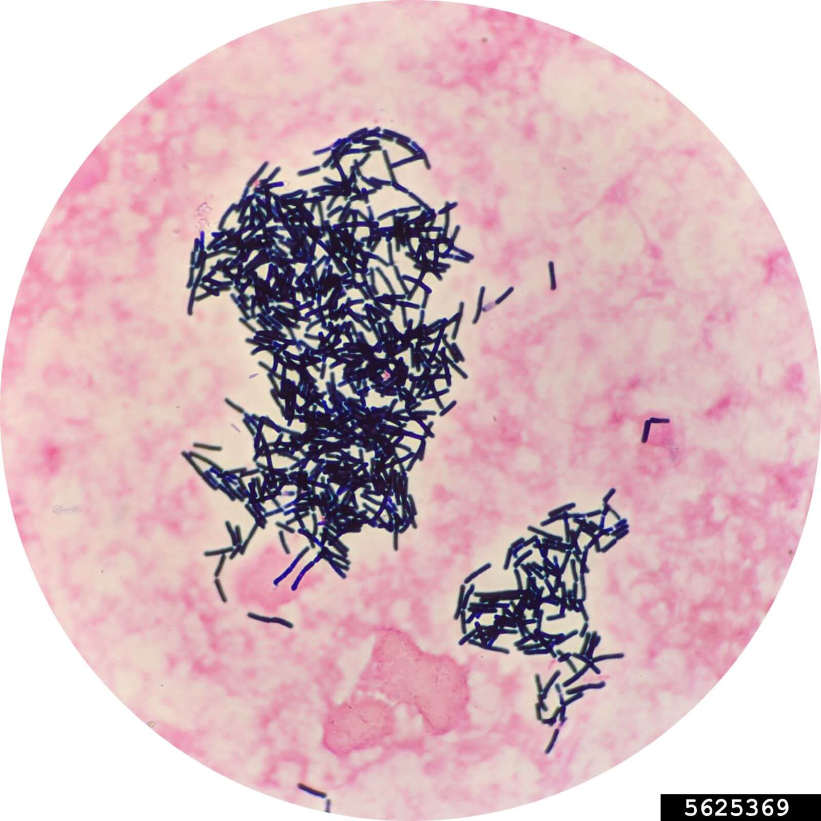 A microscopic view showing the rod-shape bacteria bacillus thurigiensis